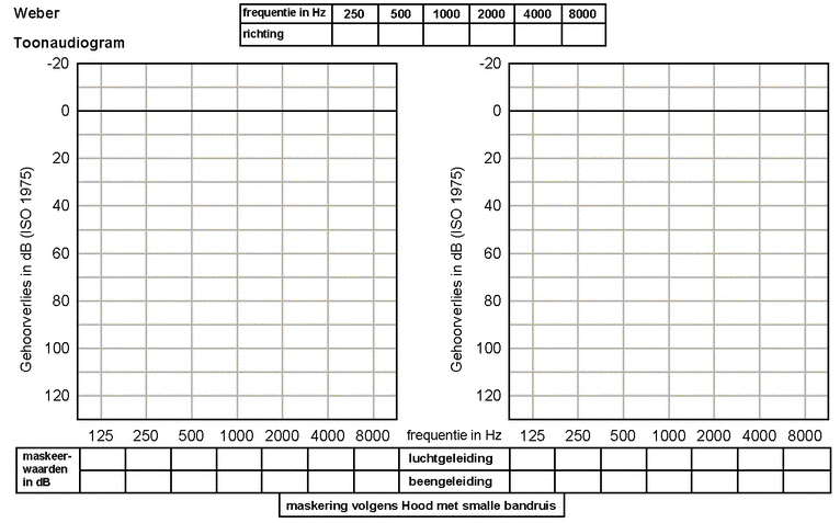 audiogram